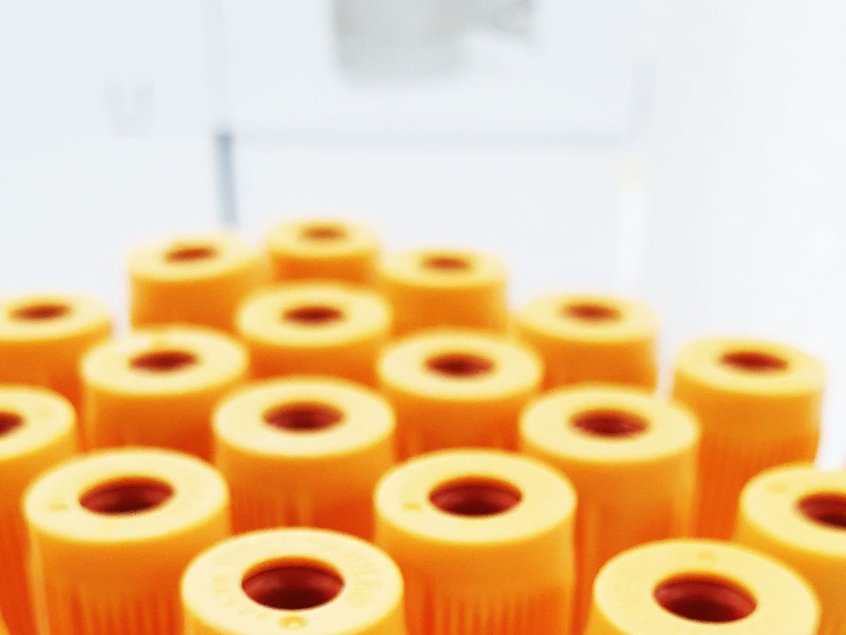Drug and alcohol testing